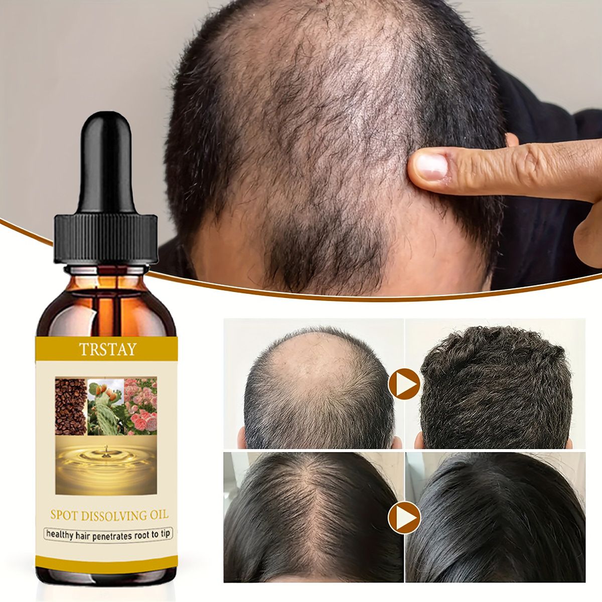 50ML Beard Growth Oil Anti Alo - огляд і ціна Beard Oil